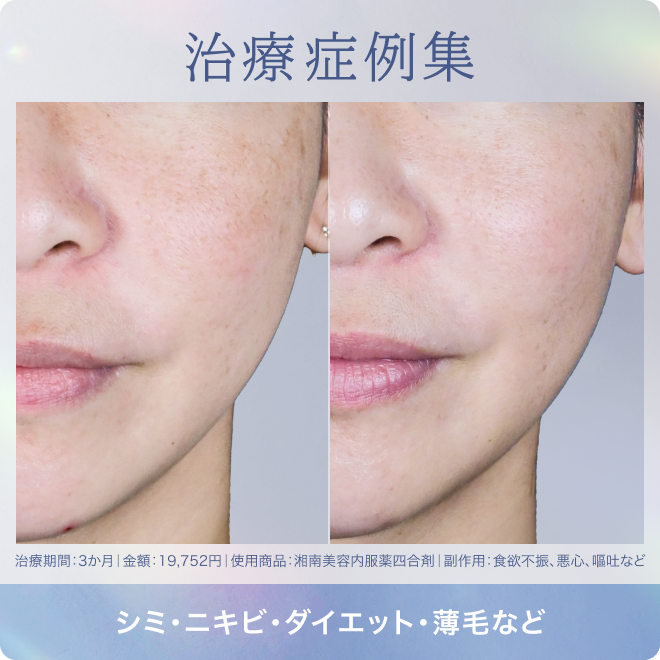 治療症例集 | シミ・ニキビ・ダイエット・薄毛など