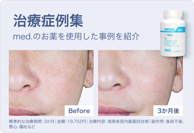 治療症例 | med.のお薬を使用した事例を紹介