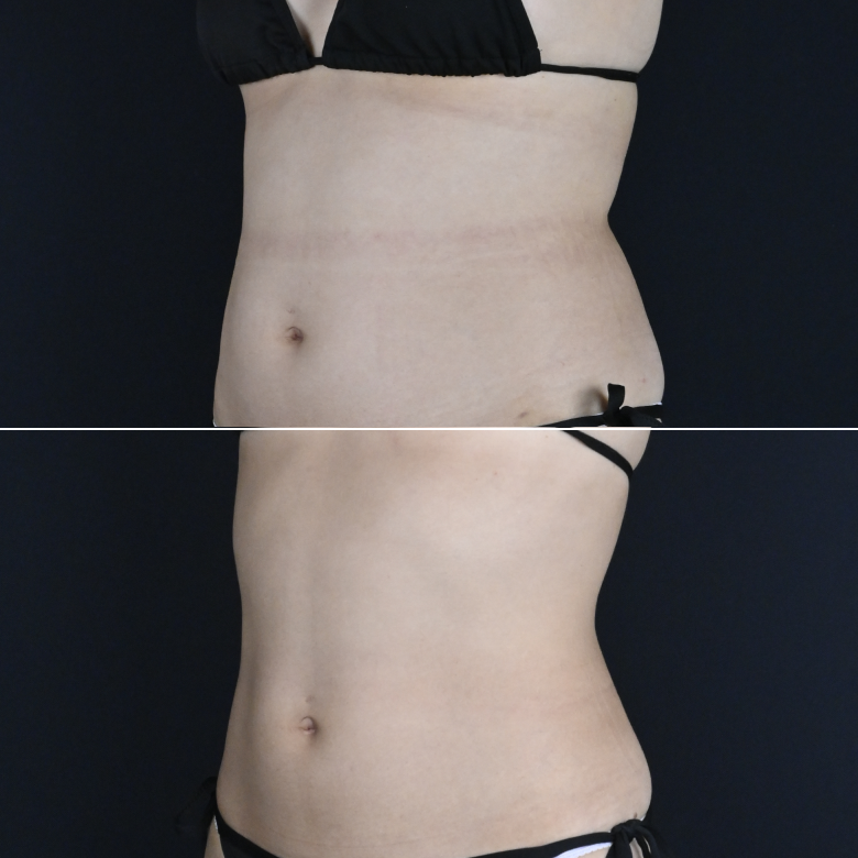 ダイエット治療