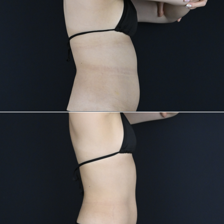 ダイエット治療