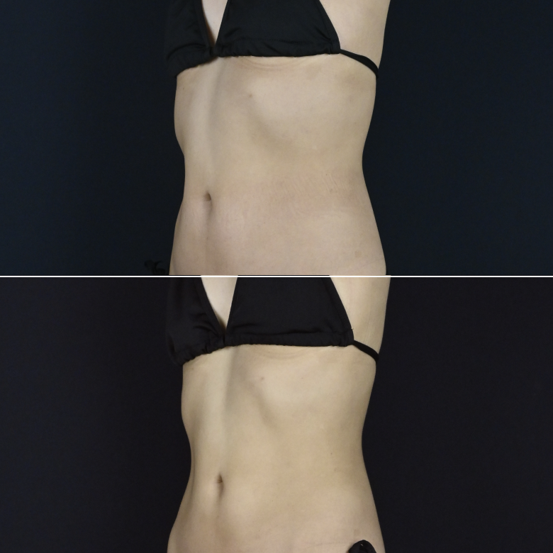 ダイエット治療