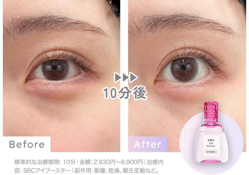 SBCアイブースター「湘南美容のデカ目薬」の通販｜楽天・湘南美容のお