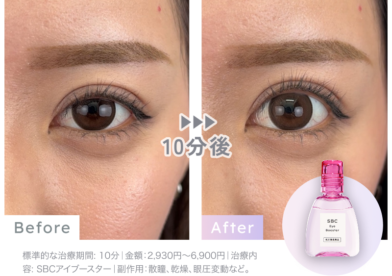 SBCアイブースター「湘南美容のデカ目薬」の通販｜楽天・湘南美容のお