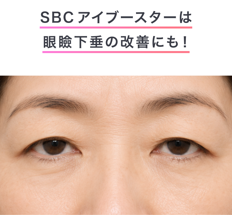 SBCアイブースターは眼瞼下垂の改善にも！