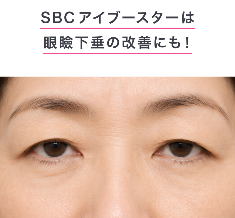 SBCアイブースター「湘南美容のデカ目薬」の通販｜楽天・湘南美容のお
