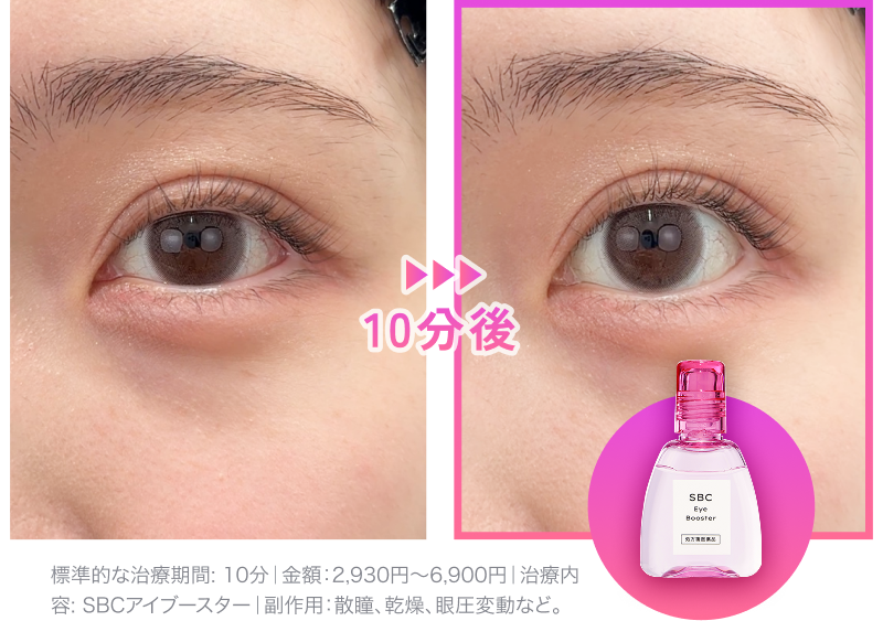 ★新品・未開封★ 湘南美容外科 SBCアイブースター SBCアイブースター「湘南美容のデカ目薬」の通販｜楽天・湘南美容のお