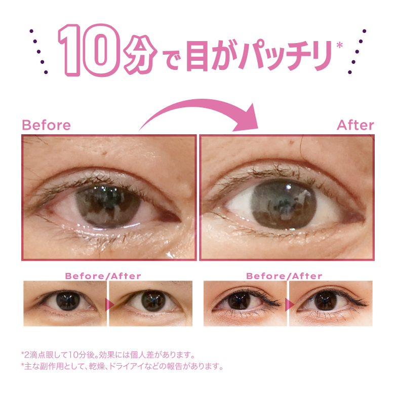 SBCアイブースター_02