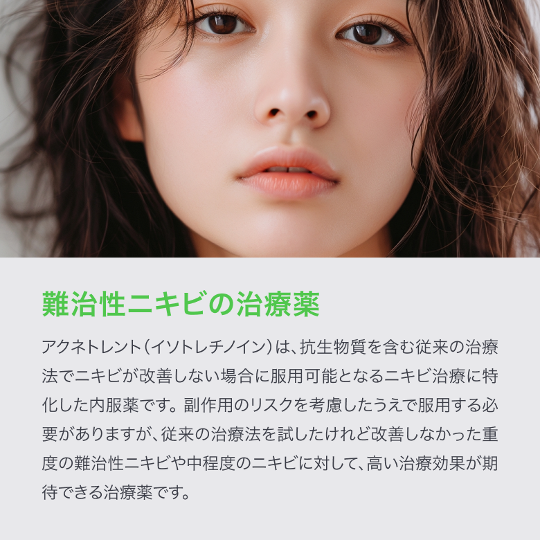 アクネトレント_03.png